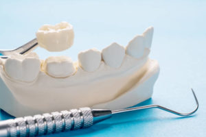 Crown and dental mold